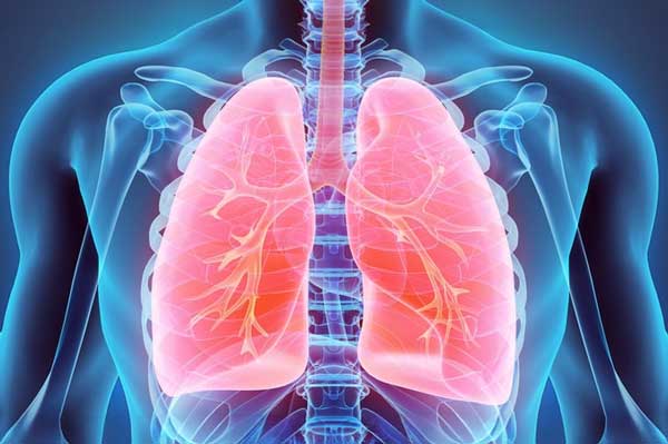 Hipertensión Pulmonar: Mirada Profunda a una Condición Compleja